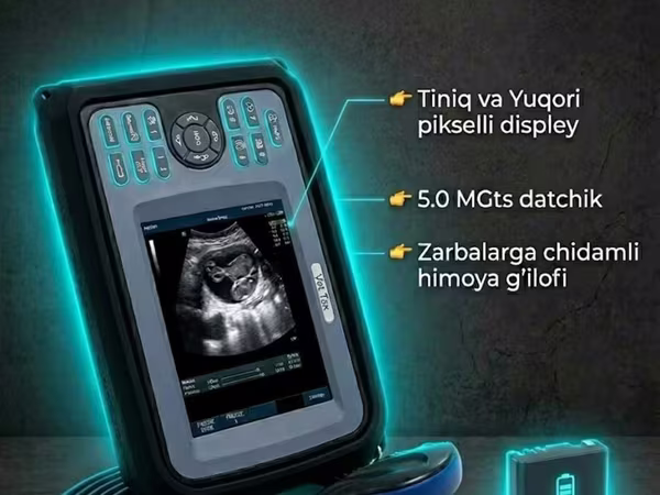 RKF08V portativ (ko'chma) ultratovush tekshiruvi (UZI) apparati