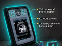 RKF08V portativ (ko'chma) ultratovush tekshiruvi (UZI) apparati — foto 1